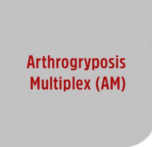 Arthrogryposis-Multiplex-AM image